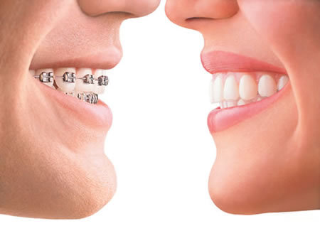 Options in Orthodontic Treatment