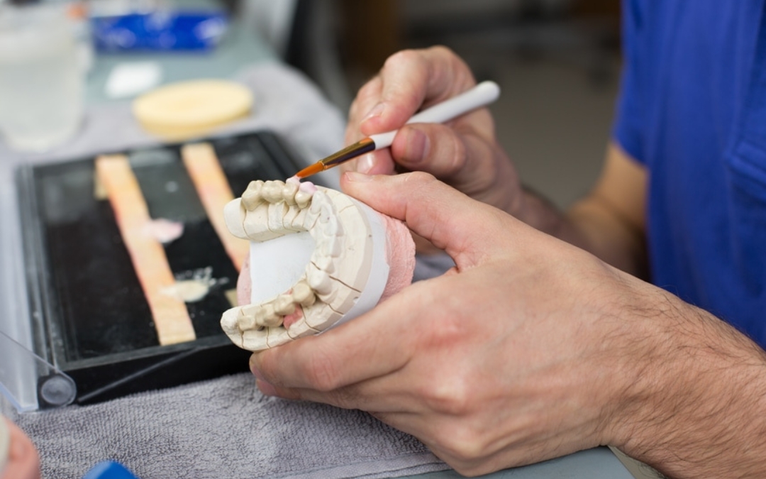 Crowns or Fillings, Which is Best for Me?