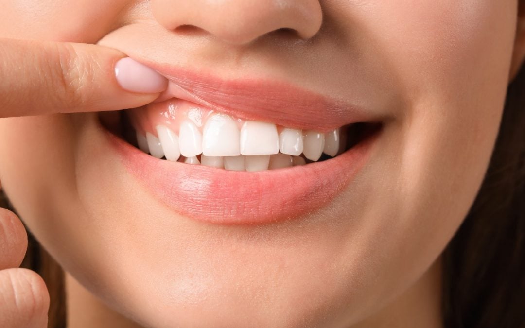 Signs Your Gums Need Help