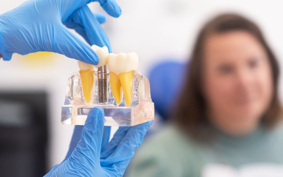 Can You Get Dental Implants If You Have Gum Disease?