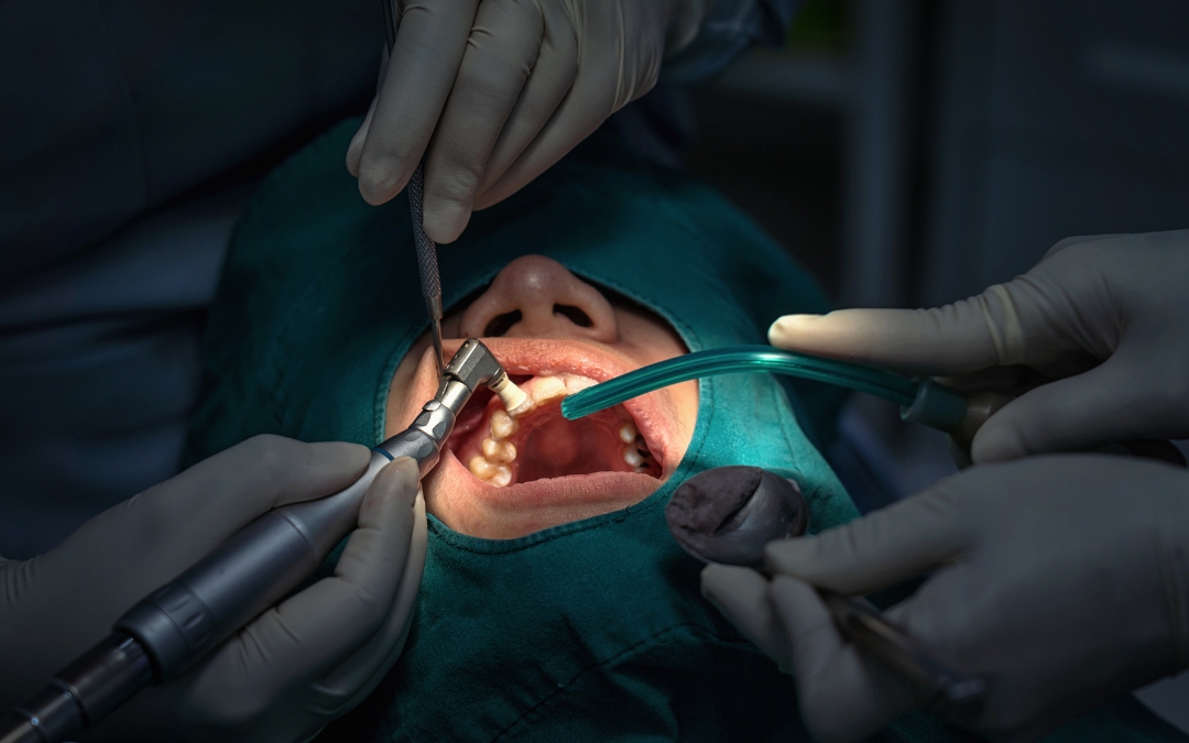 When Is Oral Surgery Necessary? Signs You Should See a Dentist