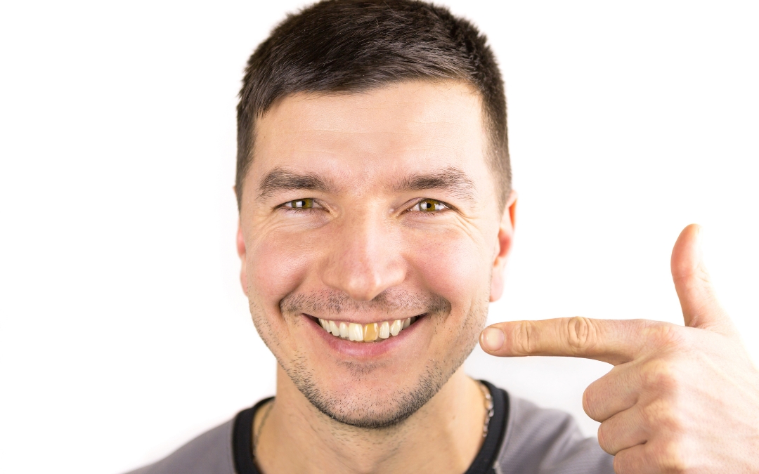 Tooth Turning Black But No Pain? Discover the Reasons