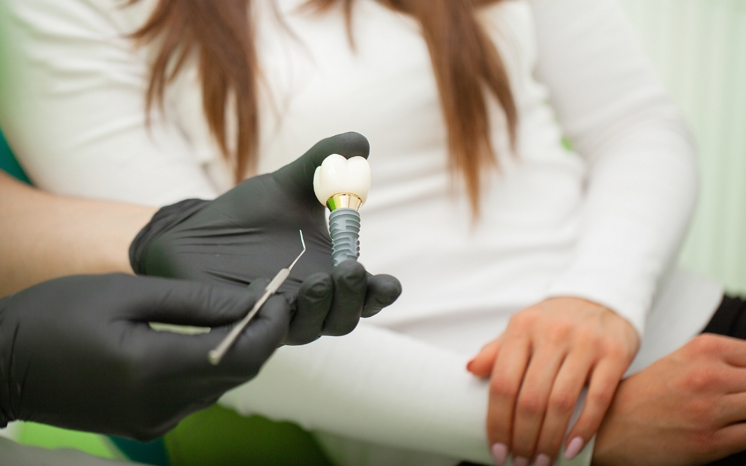 Do Dental Implants Require Special Care or Cleaning?
