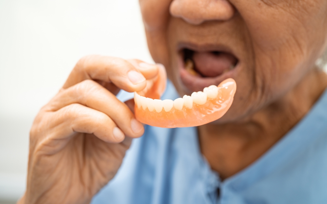 Loose Dentures Don’t Worry! Simple Ways to Improve the Fit