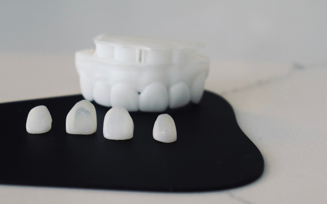 How Does A Dentist Remove A Dental Crown?